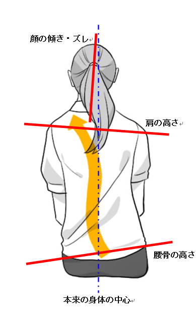身体のゆがみ:超簡単セルフチェック