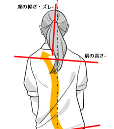 身体のゆがみ：超簡単セルフチェック